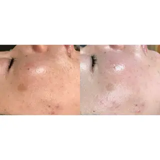 脱毛和みサロン新茶屋所属・脱毛和みサロン新茶屋 ひろみ（女性専用）のエステ・リラクイメージ