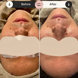 男女兼用脱毛＆ドライ ヘッドスパ トレテルのエステ・リラクイメージ