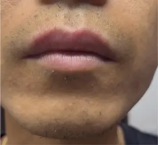 光フェイシャル・ヒゲ脱毛専門店　JiJi所属・脱毛屋 JiJiのエステ・リラクイメージ