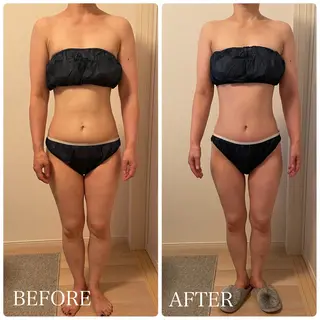 痩身小顔IRISER Akiのエステ・リラクイメージ