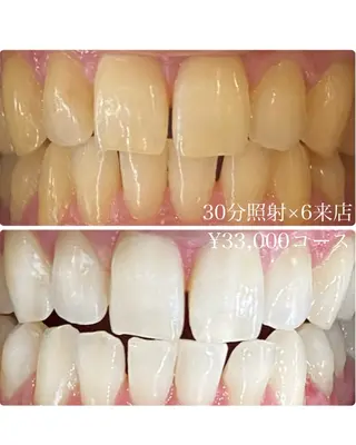 メンズ ホワイトニングルーム　川崎店所属・ホワイトニング ルーム　川崎店のその他イメージ