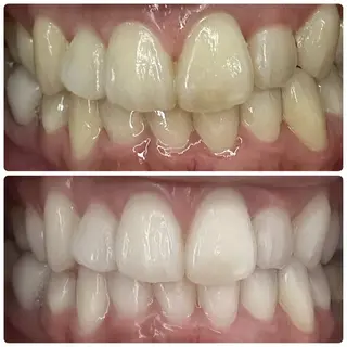 歯のホワイトニング専門店＆white所属・歯のホワイトニング 専門店&whiteのその他イメージ