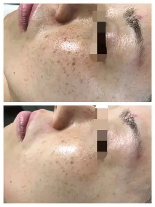 La beauté et santé岡崎店所属・望月 はるかのエステ・リラクイメージ