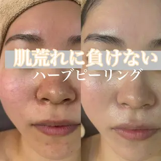 WHITE AQUA 北千住店のエステ・リラクイメージ