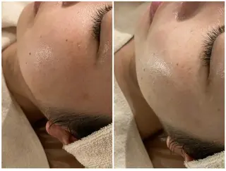 エステfreep takamoriのエステ・リラクイメージ