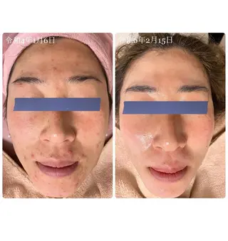 La Colzaのネイルデザイン