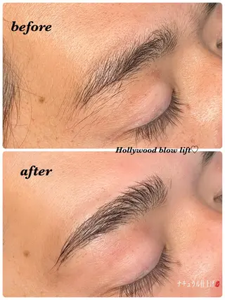 アイブロウ ハーブピーリング/韓国肌管理/フェイシャル/毛穴洗浄/眉毛/顔脱毛【糸脱毛専門】rev所属・ハーブピーリング🌹 毛穴洗浄❤️眉waxのエステ・リラクイメージ