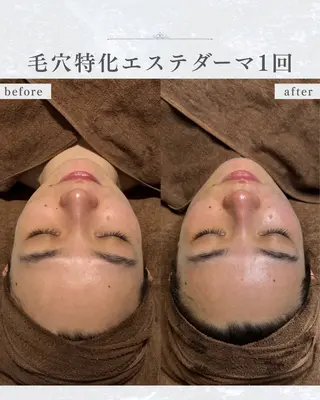 シミ取り×毛穴エステ YUKIのエステ・リラクイメージ