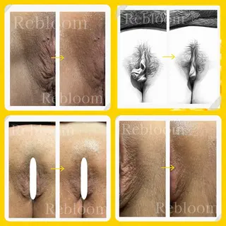 デリケートな悩み解決 Rebloomのエステ・リラクイメージ