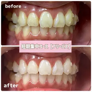 メンズ ホワイトニングサロン BE WHITE金山のその他イメージ