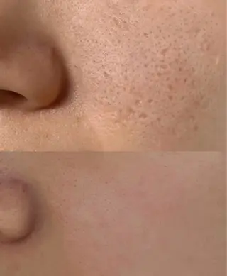 マツエク・マツパ aliaハイフ&水光ジェットサロン所属・aliaハーブ水光店 エステティシャン募集のエステ・リラクイメージ