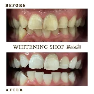 メンズ ホワイトニング ショップ葛西店のその他イメージ