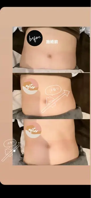 embellie アンベリー所属・アン ベリーのエステ・リラクイメージ