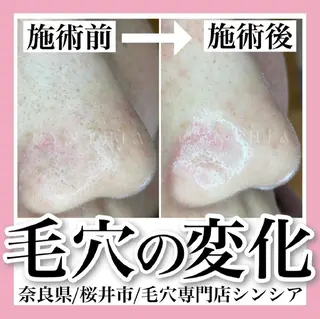 メンズ 毛穴ケア専門店 Cynthiaのエステ・リラクイメージ