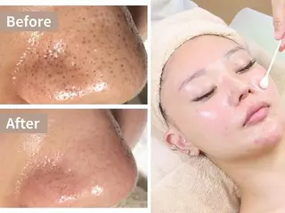 小顔コルギ・美肌 グラシーズのエステ・リラクイメージ