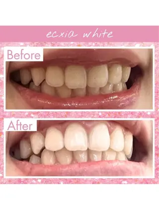 セルフホワイトニング エクシア武蔵小杉店のその他イメージ