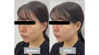 【小顔・毛穴ケア】 セラピスト　和田紋子のエステ・リラクイメージ