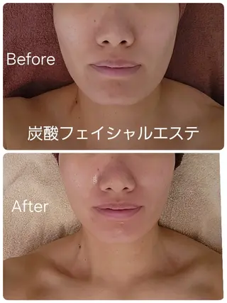 Perte所属・ . Atsumiのエステ・リラクイメージ