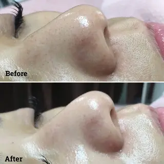 aroma  YURARI所属・韓国艶美人// 毛穴ケア🌹のエステ・リラクイメージ