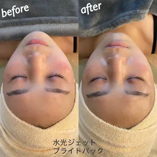 うなじ脱毛/美肌脱毛 LABELのエステ・リラクイメージ