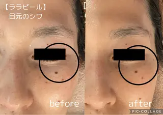 Beauty salon dessert（ビューティーサロンデザート）所属・板垣 あゆみのエステ・リラクイメージ