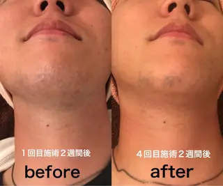 プライベートサロンLien所属・都度払い脱毛店 Lienリアンのエステ・リラクイメージ