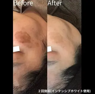 bonuru salonのエステ・リラクイメージ