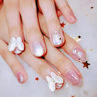 ネイル フィルイン、長さ出し 深爪矯正のネイルデザイン