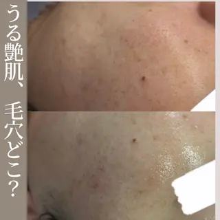 ニキビ毛穴専門店Beautysalon Luana所属・小林 まいのエステ・リラクイメージ