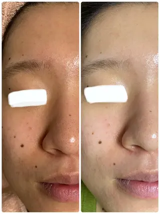 🏳️‍🌈 CHIYAKAのエステ・リラクイメージ