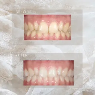 ホワイトニングサロン シロイハ所属・歯を白くしたい方🦷 シロイハのその他イメージ