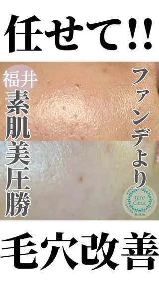 毛穴肌質ケアサロン Yourmeユアミーのエステ・リラクイメージ