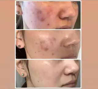 美顔秘密基地新宮所属・美顔秘密基地 新宮のその他イメージ