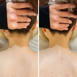 うなじ脱毛/美肌脱毛 LABELのエステ・リラクイメージ