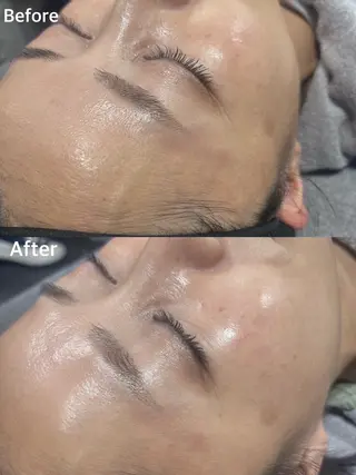 라라피（ララピ）所属・韓国式肌管理 ララピール専門のエステ・リラクイメージ