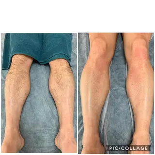 メンズ Laki wax所属・Laki wax chikaのエステ・リラクイメージ