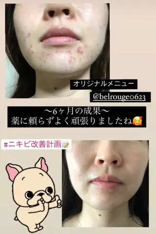 自由が丘📍 Belrougeのエステ・リラクイメージ