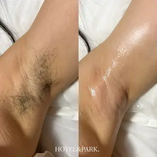 HOTEL&PARK .Moeワックス脱毛のエステ・リラクイメージ