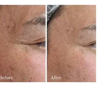 Total Beauty salon Bloom所属・肌育WISHpro 専門サロンBloomのエステ・リラクイメージ