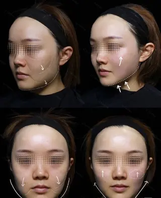 マツエク・マツパ aliaハイフ&水光ジェットサロン所属・aliaハーブ水光店 エステティシャン募集のエステ・リラクイメージ