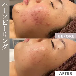 【フェムケア専門店】 PEQLIAヒロミのエステ・リラクイメージ