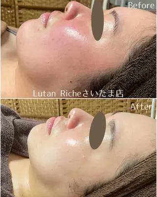 Lutan Richeさいたま店所属・ルタンリッシュ さいたま店のエステ・リラクイメージ