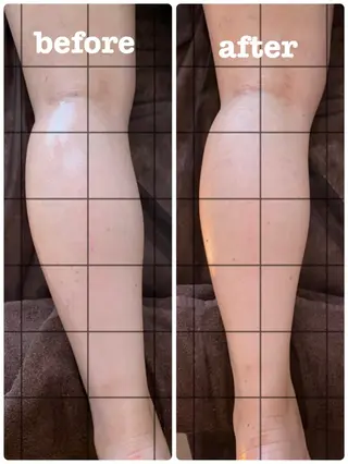 kuppy所属・lymph kuppyのエステ・リラクイメージ