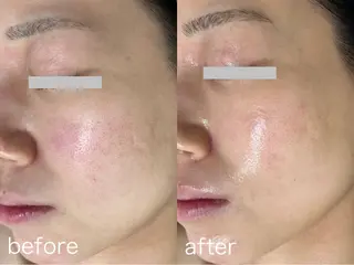 韓国美肌/肌質改善 【天神】yuiのエステ・リラクイメージ