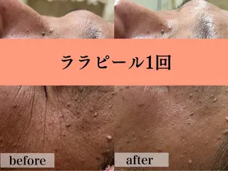 フェイシャル/脱毛 ジョアアンジェ竹田の眉毛・アイブロウイメージ