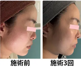 フェイシャルエステサロン 　グレースティー所属・毛穴・ニキビ専門 エステグレースティーのエステ・リラクイメージ