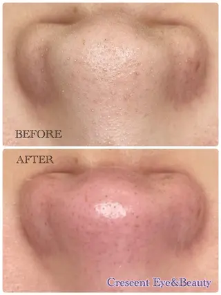 Crescent Beautyのエステ・リラクイメージ