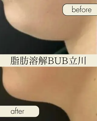 【BUB立川】 ゆかのエステ・リラクイメージ