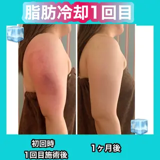 痩身/脱毛/ネイル HARUKAのエステ・リラクイメージ