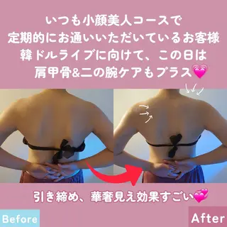 痩身ハーブピーリング 筋膜リリース☆B&Hのエステ・リラクイメージ